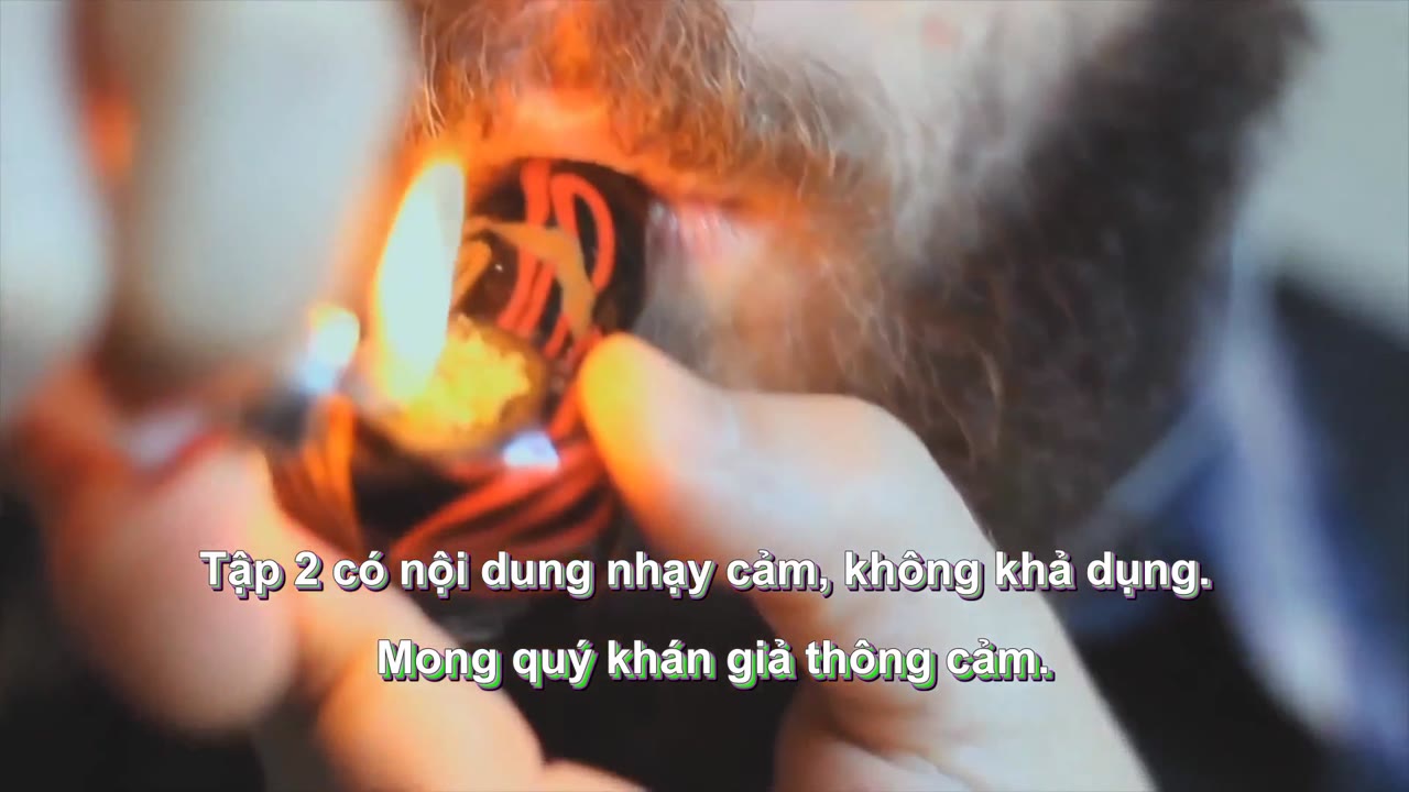 Những Vị Khách Khó Chiều (Phần 1) tập 2