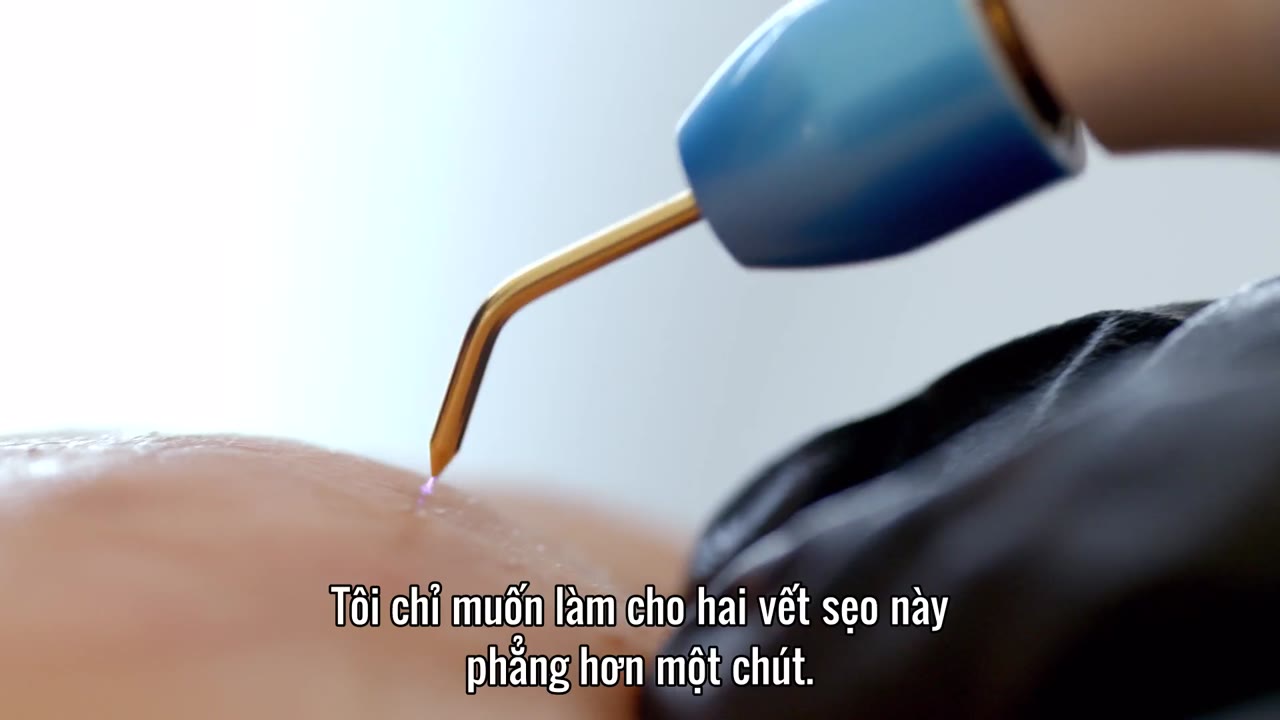 Lựa chọn lột xác: Trước và sau tập 1 cảnh 3