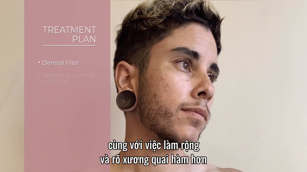 Lựa chọn lột xác: Trước và sau tập 4