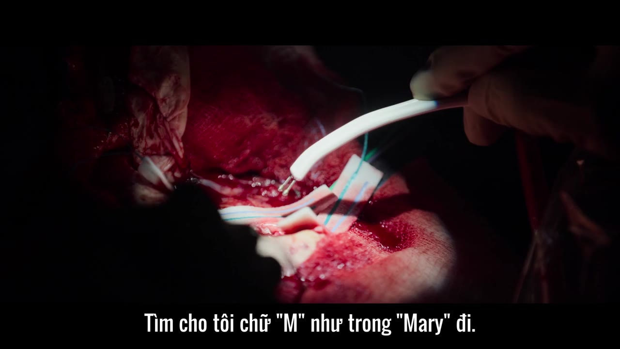 Những thiên tài phẫu thuật tập 2 cảnh 2