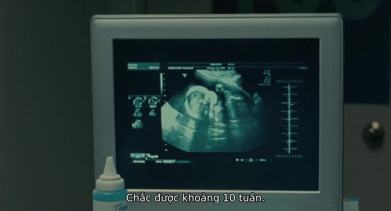 Lạc Bước Tuổi 17 tập 1