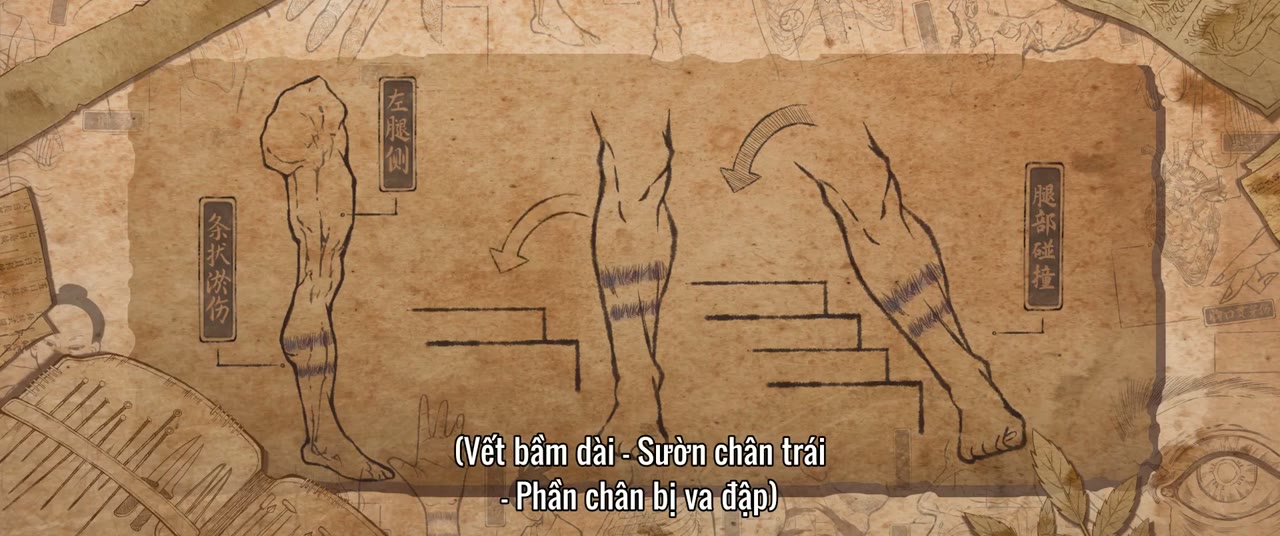 Ngự Tứ Tiểu Ngỗ Tác tập 33 cảnh 2