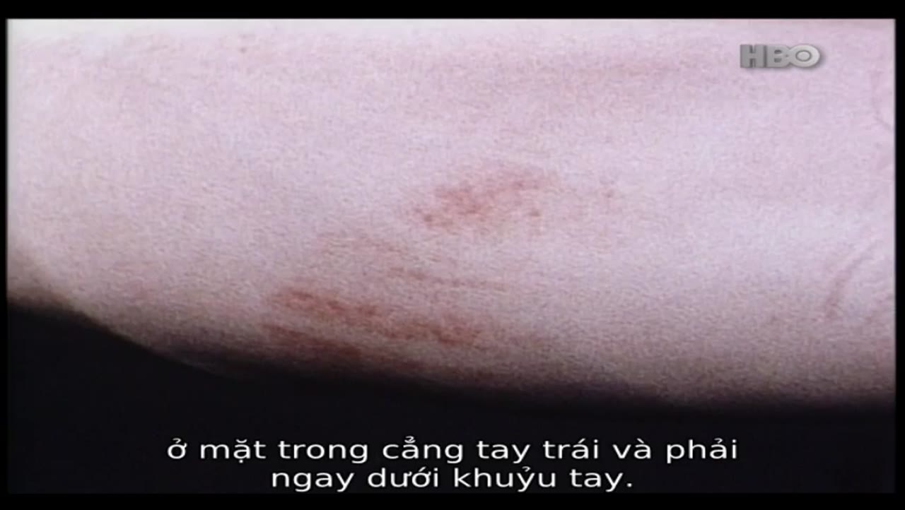 Khám Nghiệm Tử Thi 4: Người Chết Lên Tiếng - cảnh 1